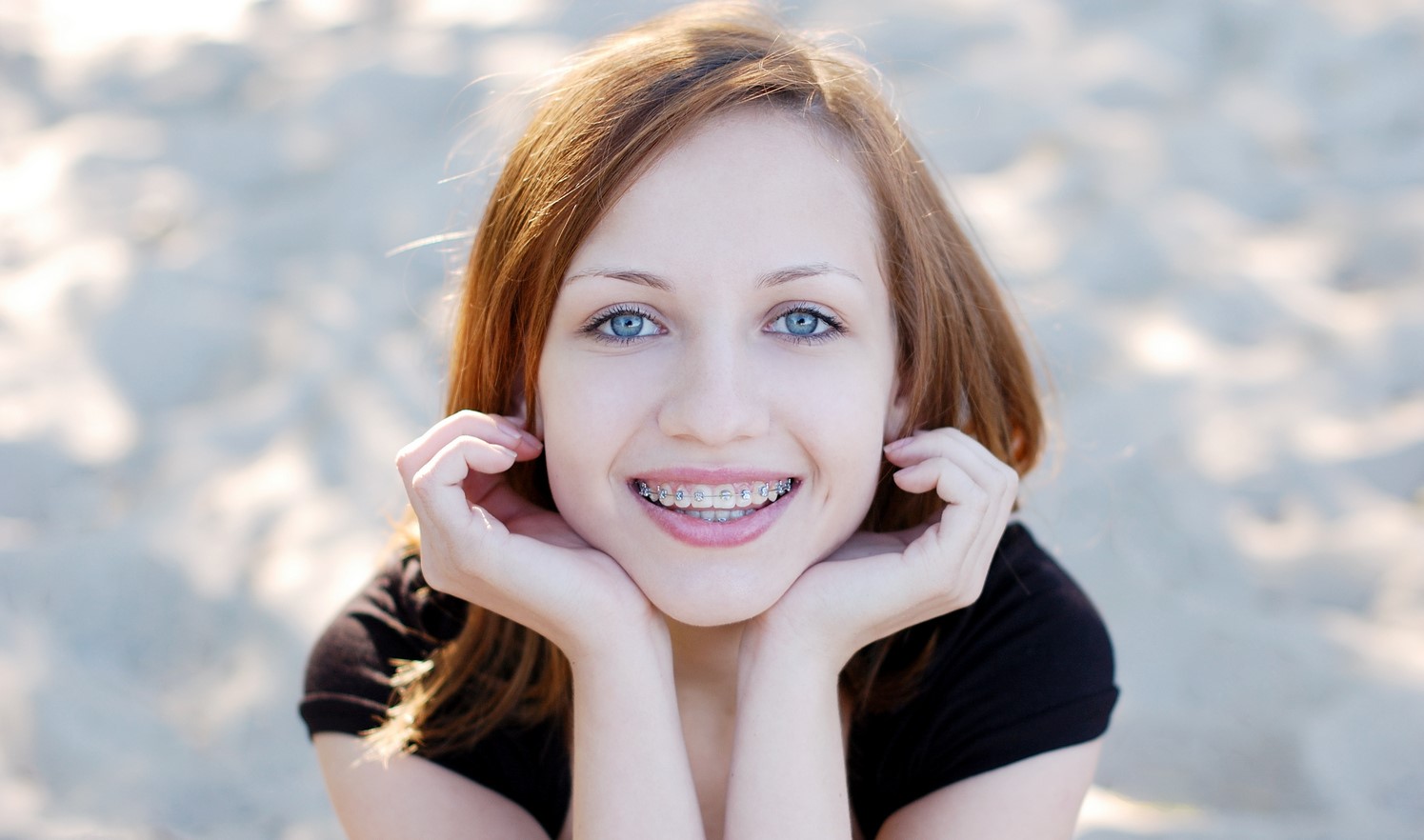 teenager with braces image