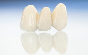 dental partial image